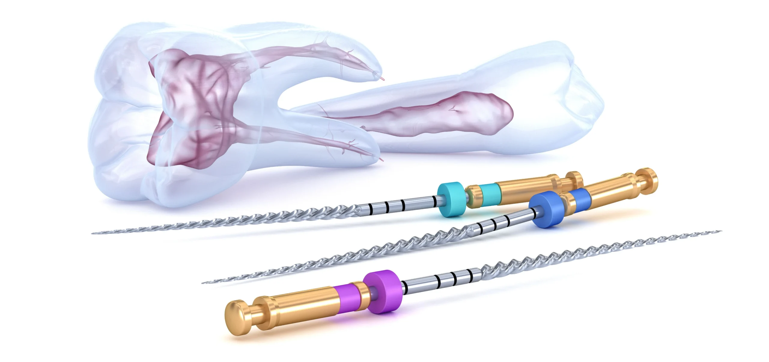 endodontie racine devitalisation marseille