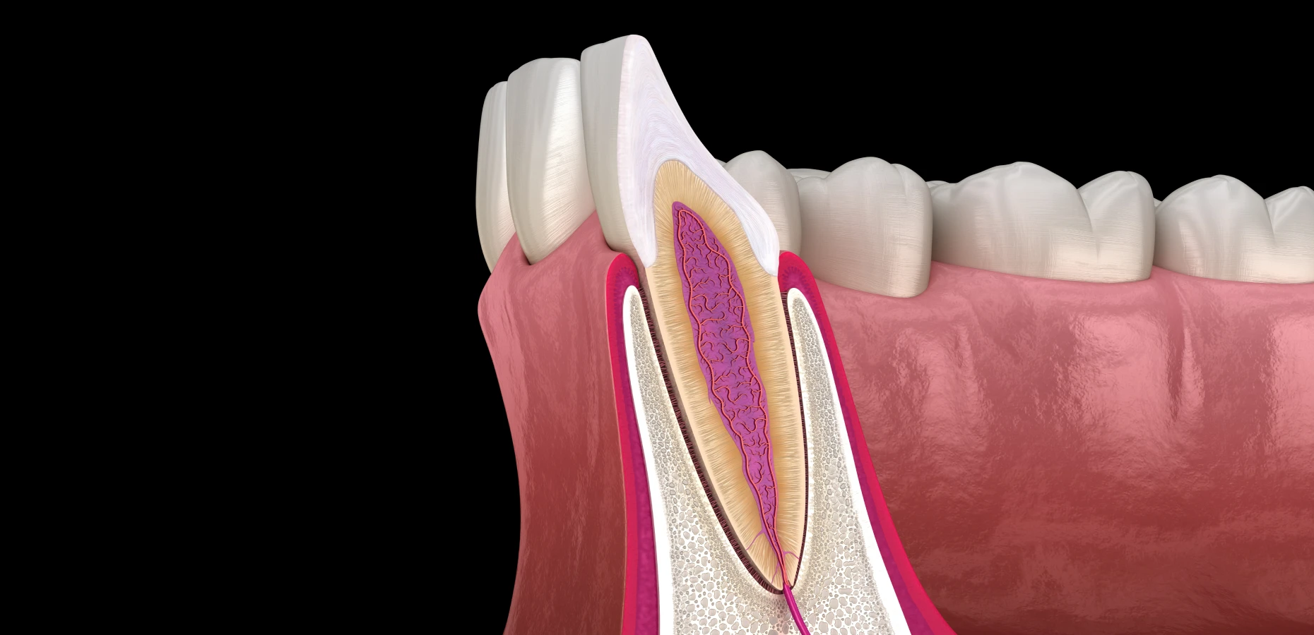resection apicale marseille